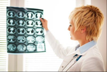 IRM Cerebral in epilepsie | Imagistica Cerebrala